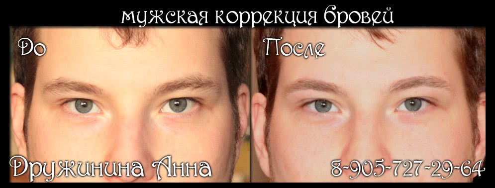 сросшиеся брови у мужчин фото до и после