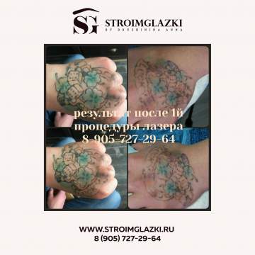 Как убрать татуаж бровей: 8 способов избавиться даже от самого старого татуажа - luchistii-sudak.ru