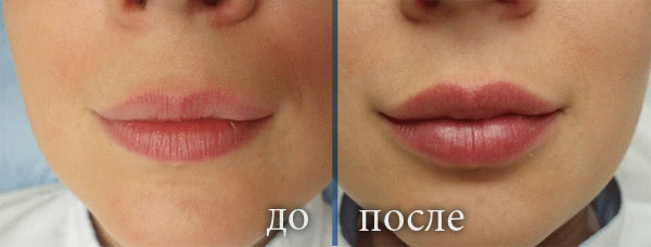 губы 3д татуаж фото до и после